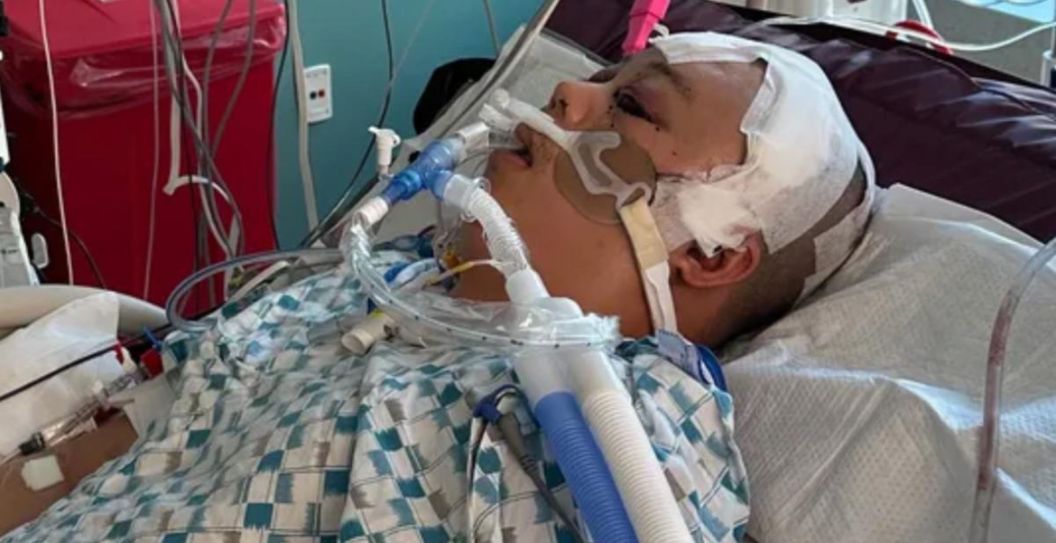 Oakland Father Struck By Stray Bullet While Taking A Nap At Home