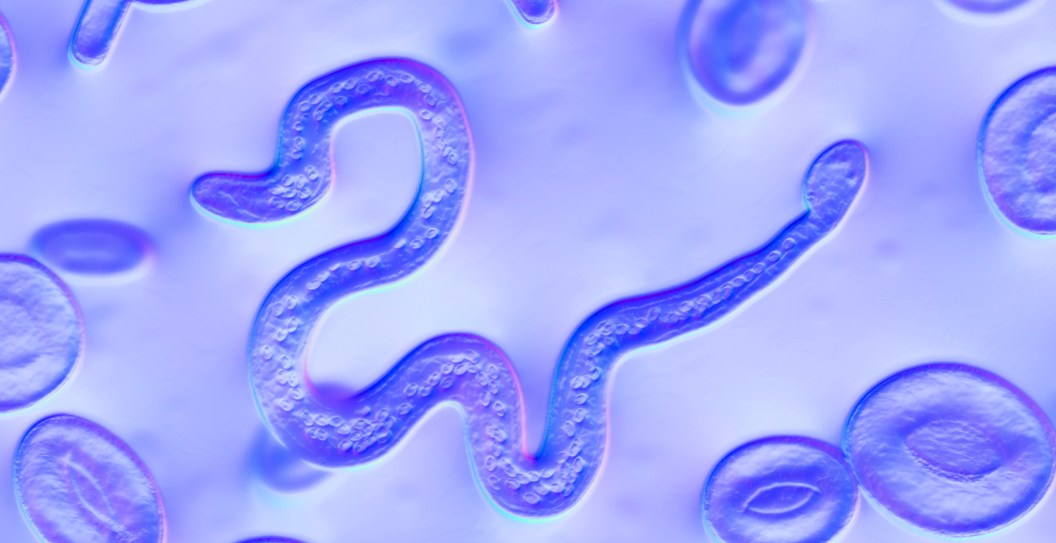 texas woman left with parasites in her eye
