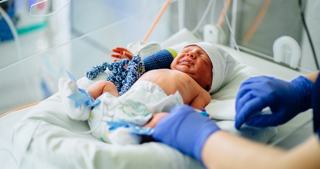 baby in the NICU