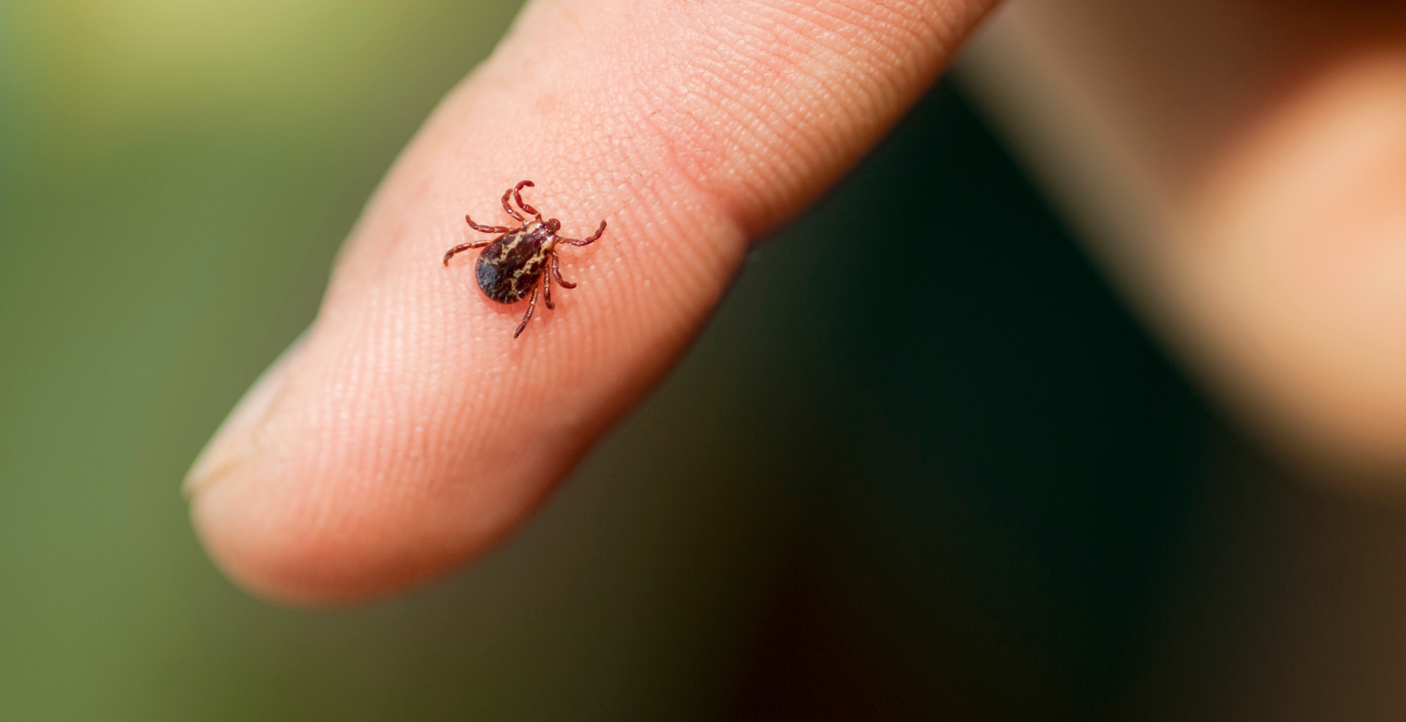 Former NFL Star Opens Up About the Horrible Realities of Having Lyme Disease