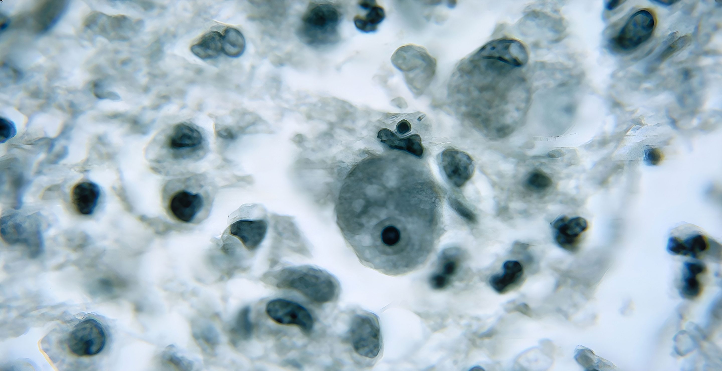 amoeba