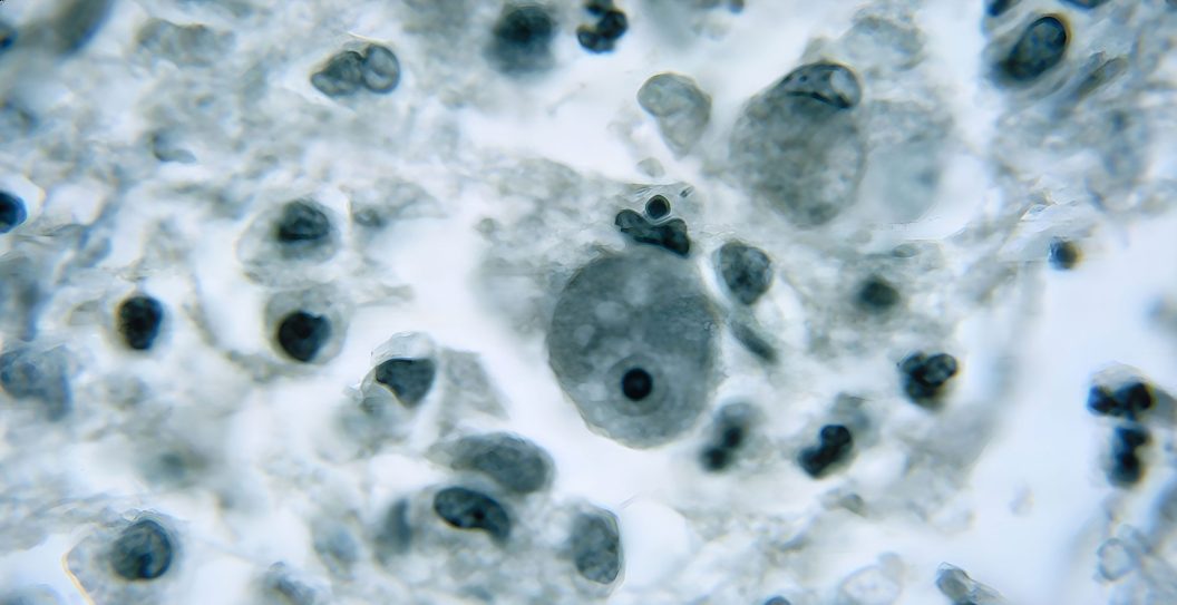 amoeba