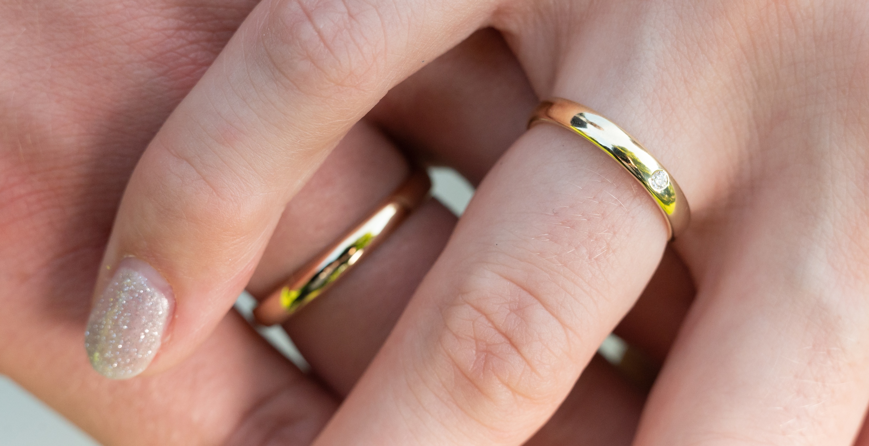 Man With Advanced Colon Cancer Renews Wedding Vows With His Beloved ...