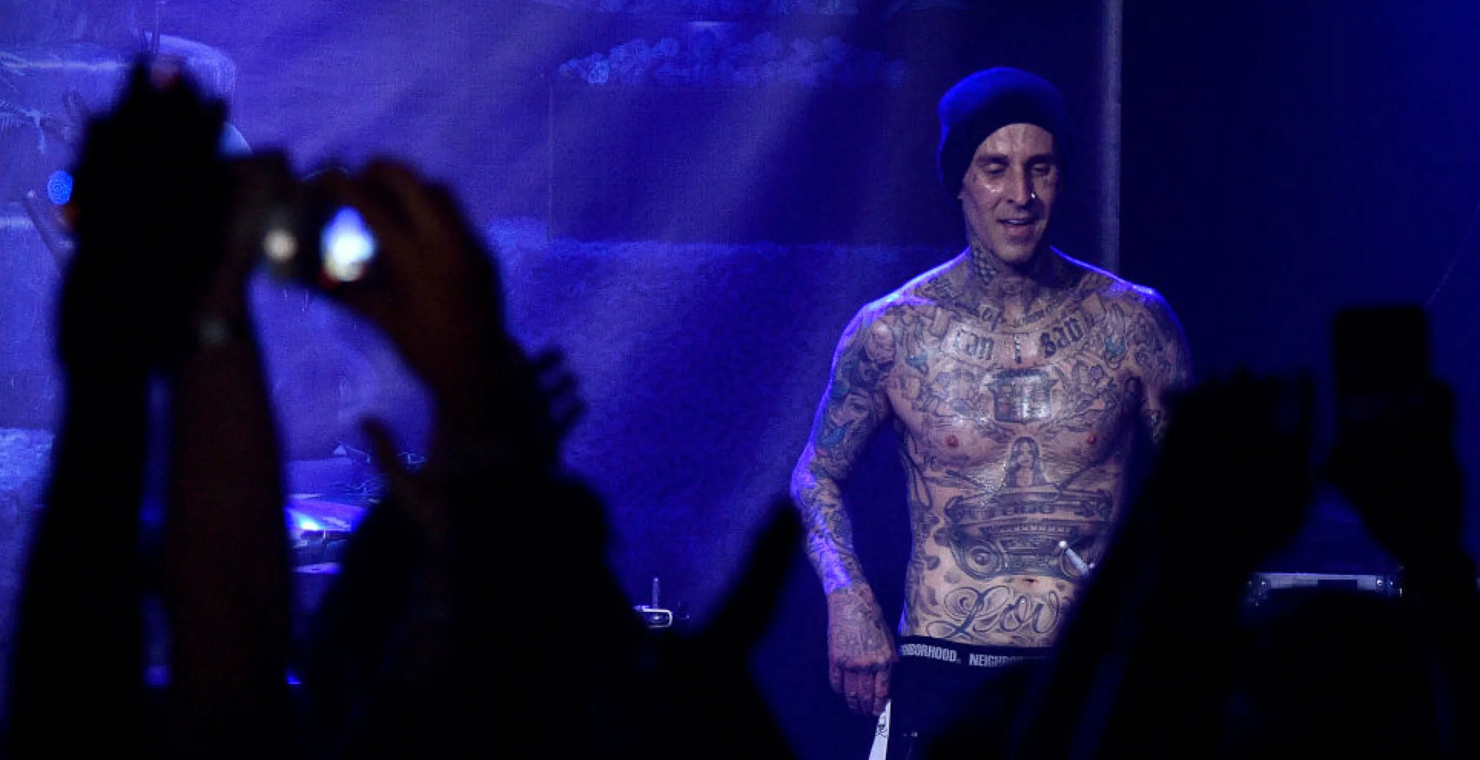 Popular Rock Star Hospitalized, Undergoes Surgery